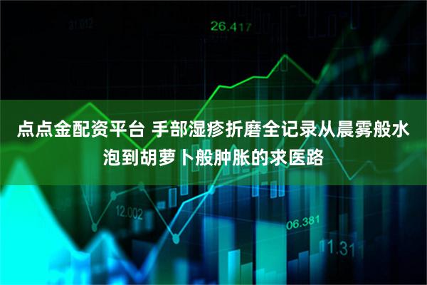 点点金配资平台 手部湿疹折磨全记录从晨雾般水泡到胡萝卜般肿胀的求医路